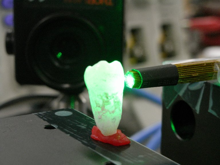 歯牙の光学特性測定