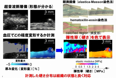 elastcity