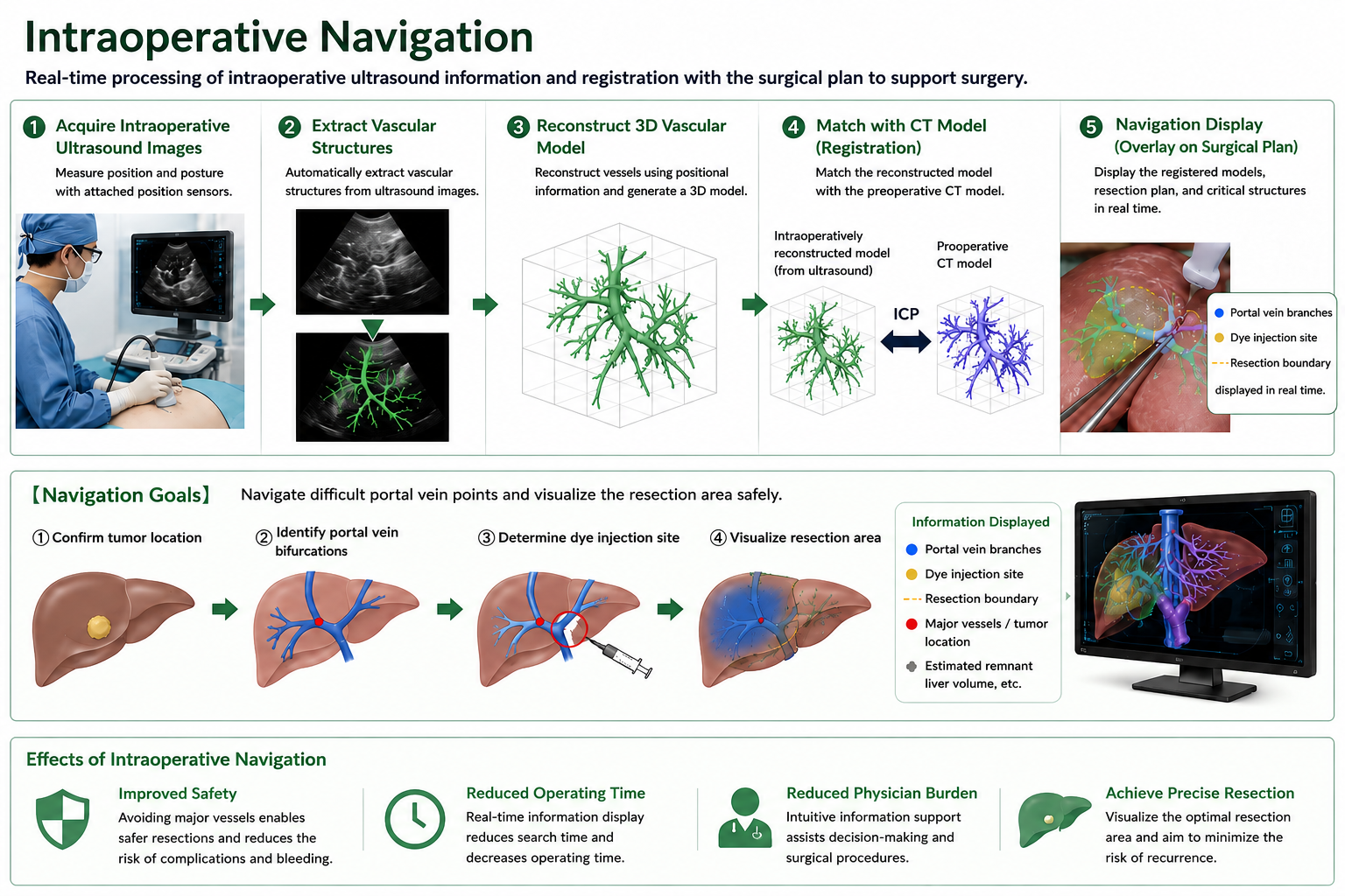 Workflow of intraoperative navigation for liver surgery