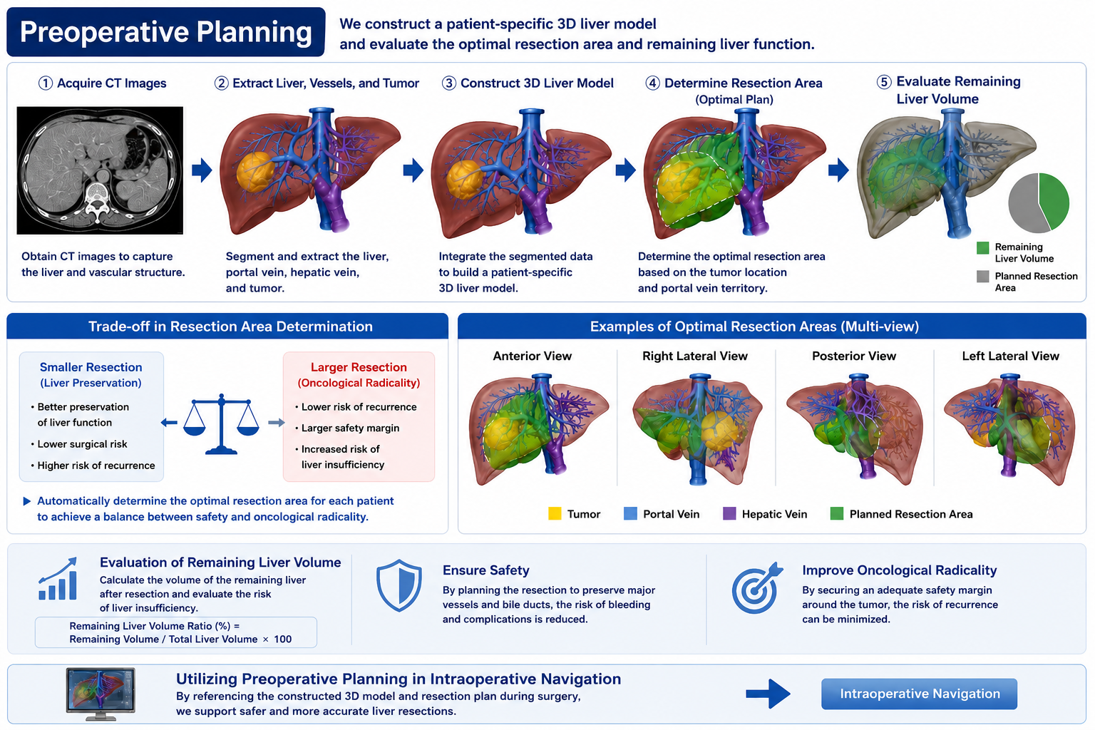 Workflow of preoperative planning for liver surgery