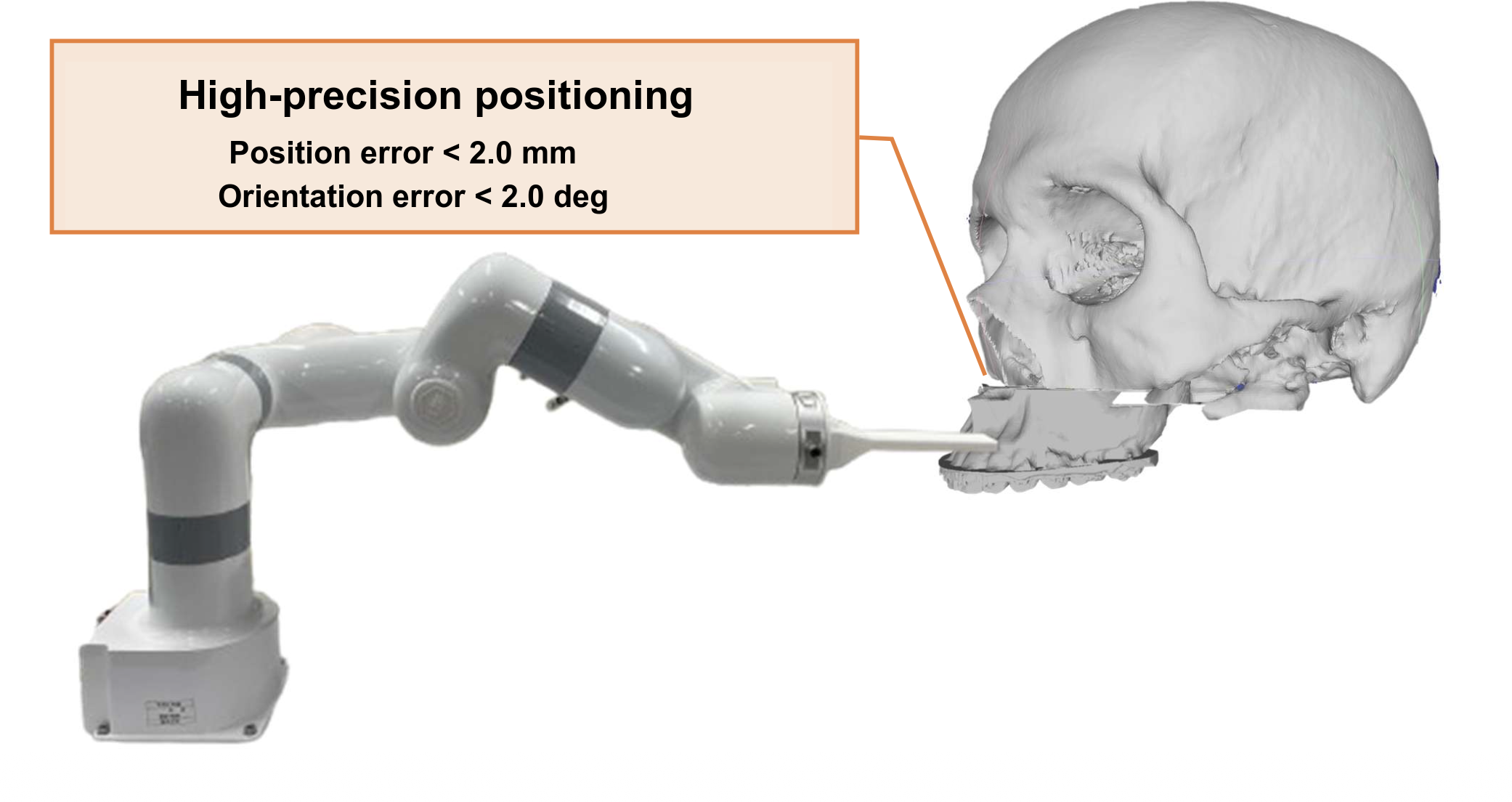 Robotic positioning support for maxillary bone segments in Le Fort I osteotomy